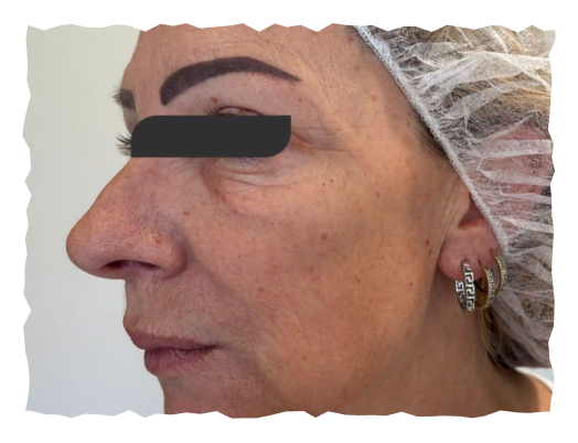 pre-slika-labelage-solutions