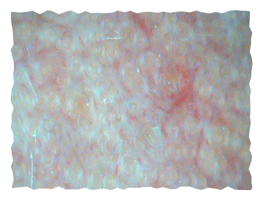 posle-slika-labelage-solutions